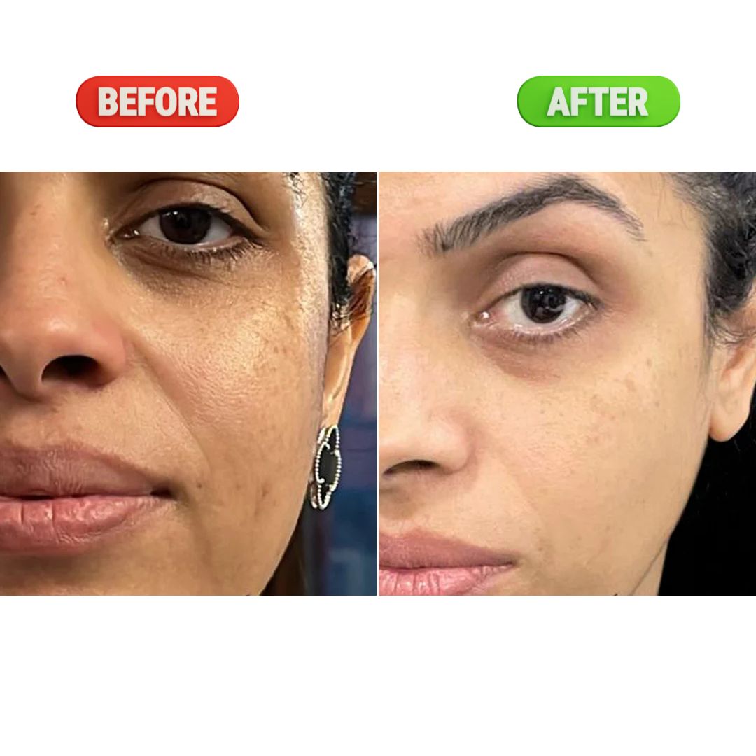 Super Powerful Cream For Skin Whitening Visible Results in 7 days