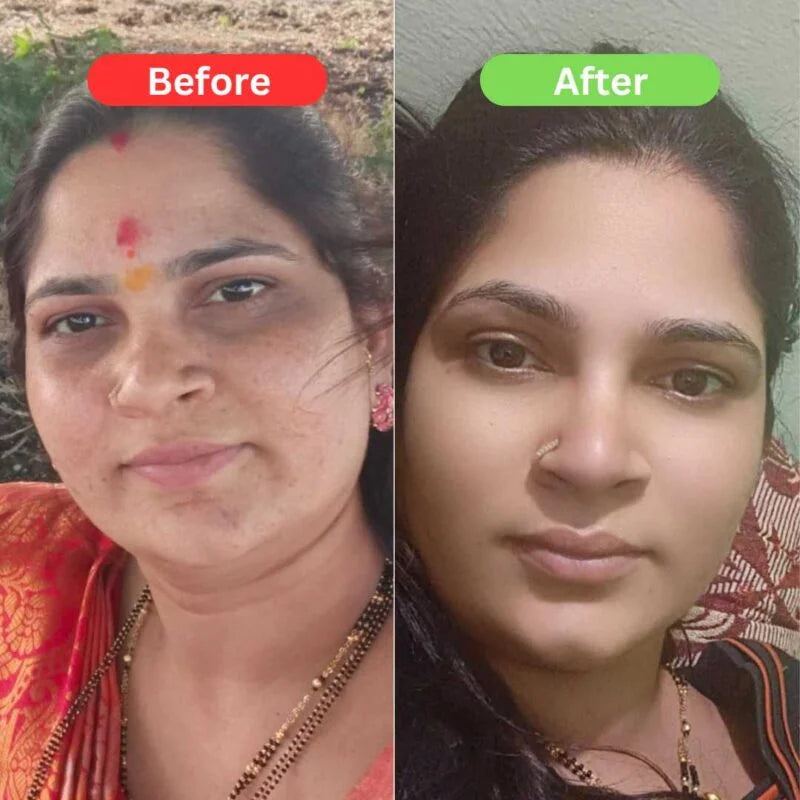 Face Whitening kit For Bright Skin With Free Rose Soap