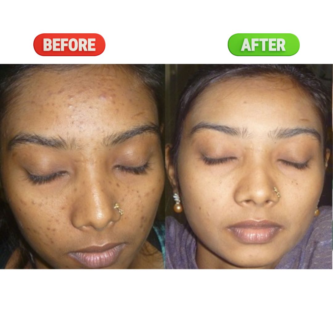 Super Powerful Cream For Skin Whitening Visible Results in 7 days