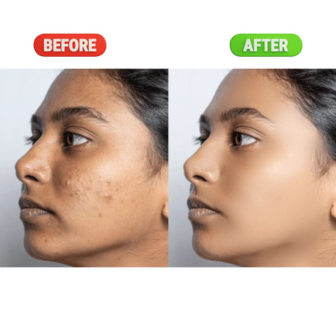 Super Powerful Cream For Skin Whitening Visible Results in 7 days