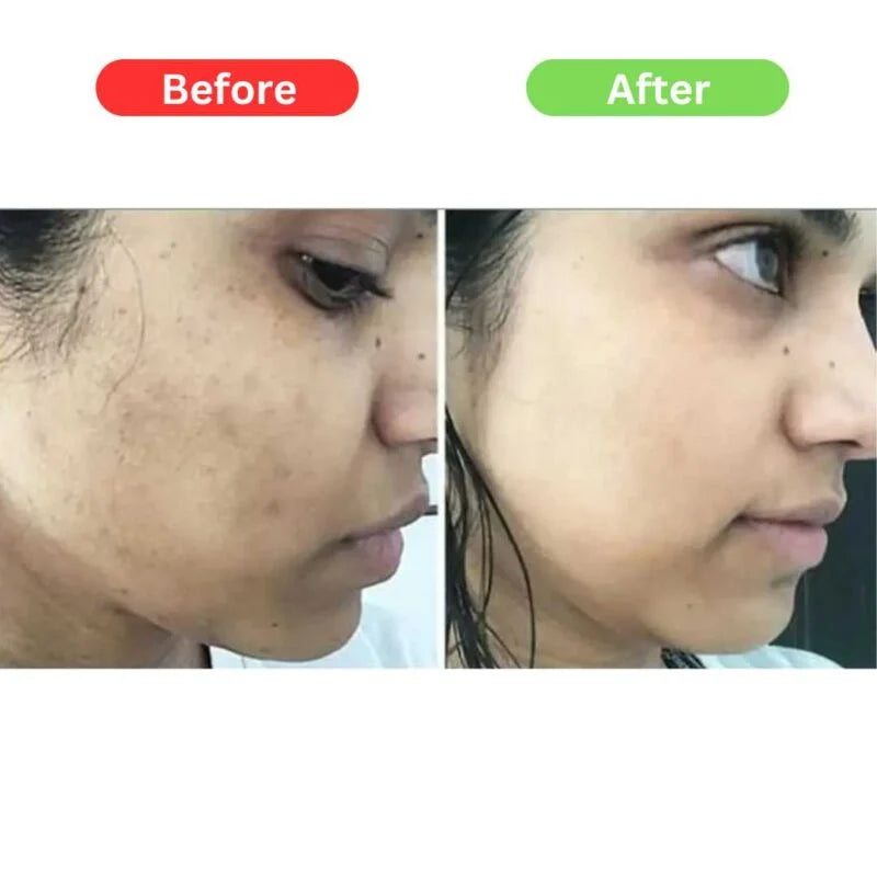 Super Powerful Cream For Skin Whitening Visible Results in 7 days