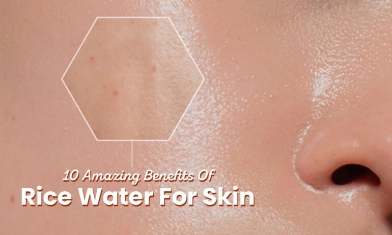 Fiza Rose By Mrgrowth.in